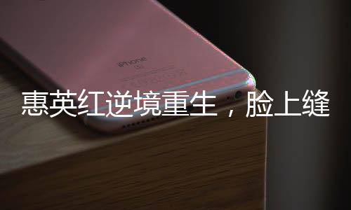 惠英紅逆境重生，臉上縫了89針的堅韌故事