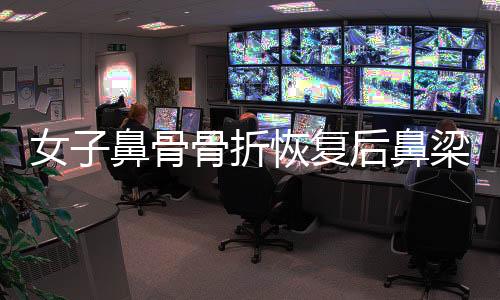 女子鼻骨骨折恢復(fù)后鼻梁提升，重拾自信美麗